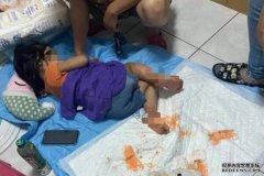 沐鸣直属招商4岁女双脚烫伤溃烂不送医治 疑遭生母继父虐待