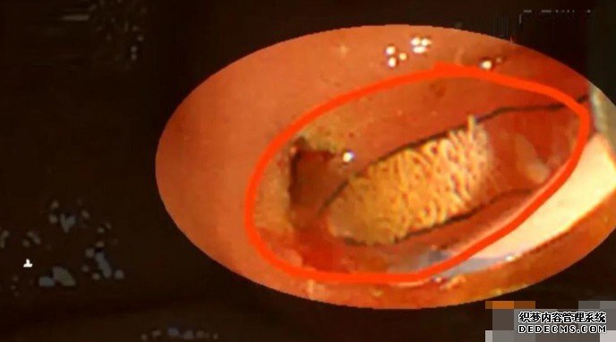 广东男常生食淡水鱼虾 沐鸣直属代理体内肝脏排出活虫