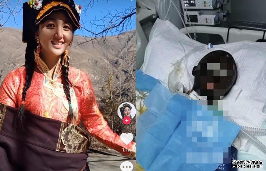 沐鸣总代理藏族美女网红遭前夫淋汽油烧伤 与死神搏斗16天后离世